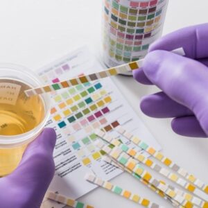 drug alcohol testing