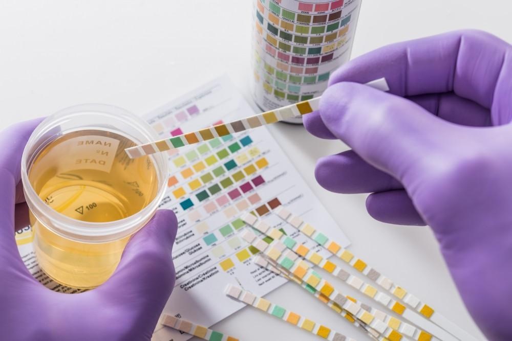 drug alcohol testing